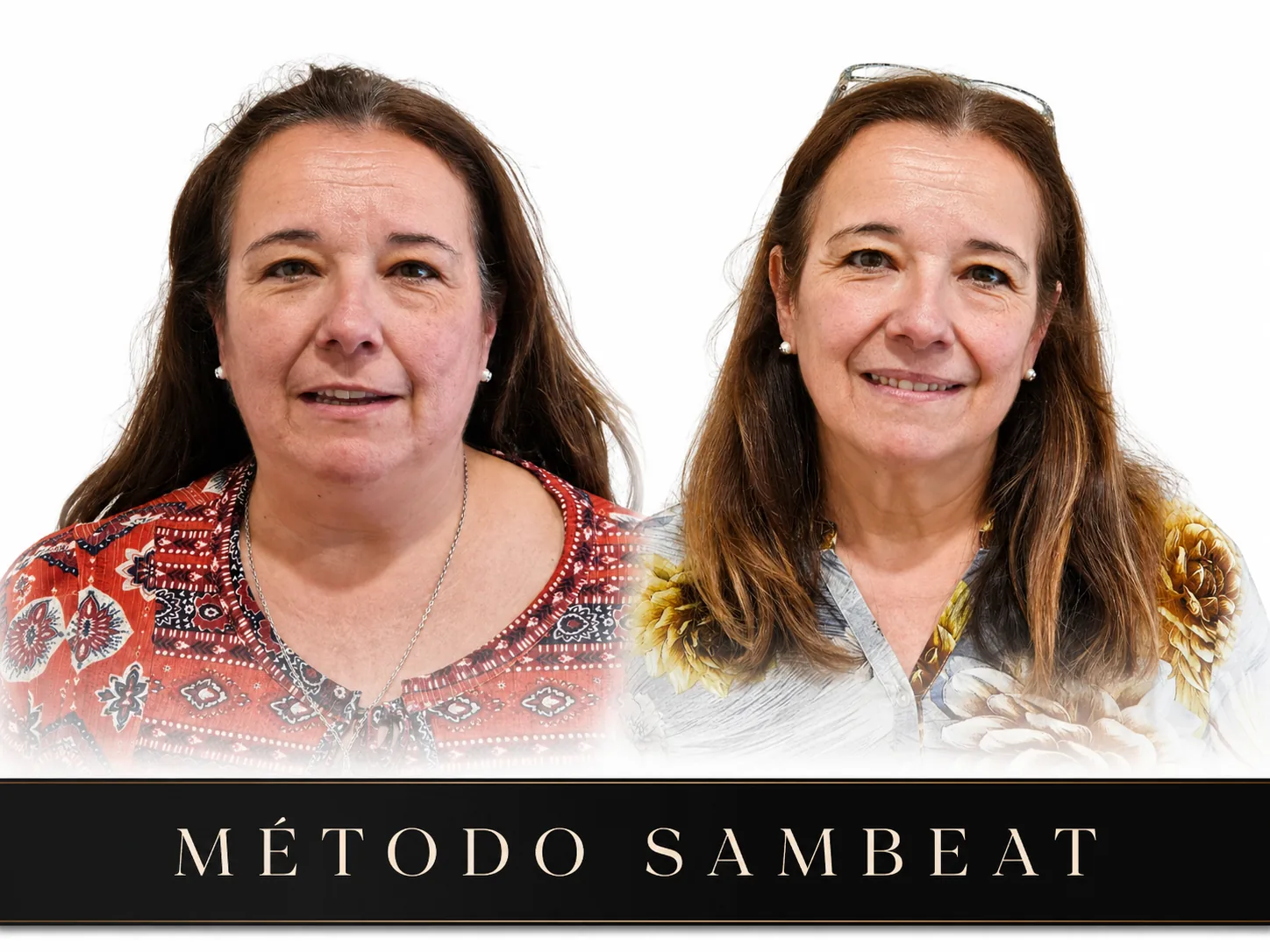 Ana_R Caso real antes y después con el Método Sambeat Ana R. Comparativa visual de antes y después de un caso real tratado con el Método Sambeat