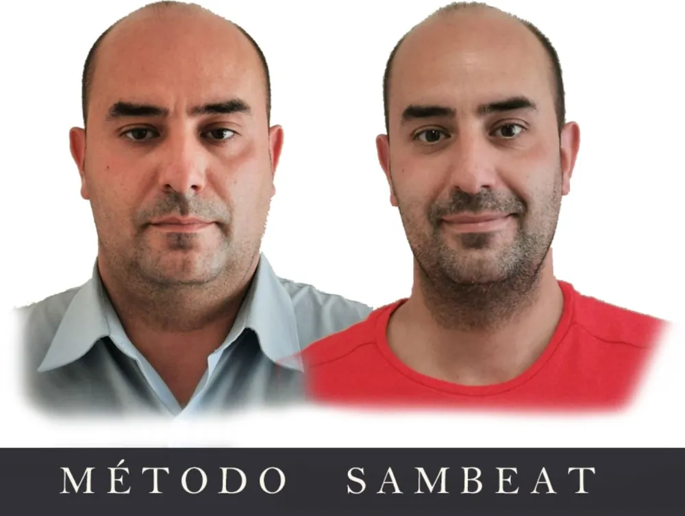 Evolución de Jesús F. con el Método Sambeat Antes y después de Jesús F. durante su proceso con el Método Sambeat