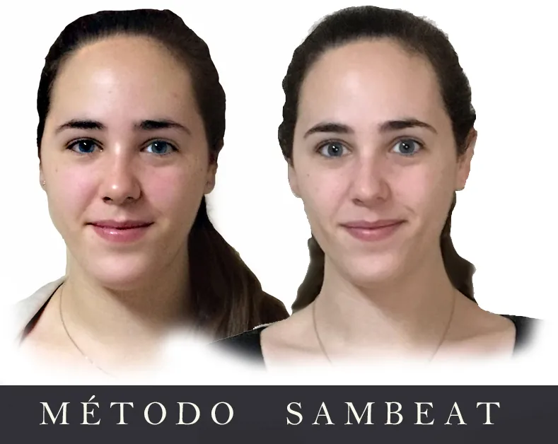 Resultado de Paloma P. con el Método Sambeat Comparativa visual de Paloma P. antes y después de su proceso con el Método Sambeat<br />